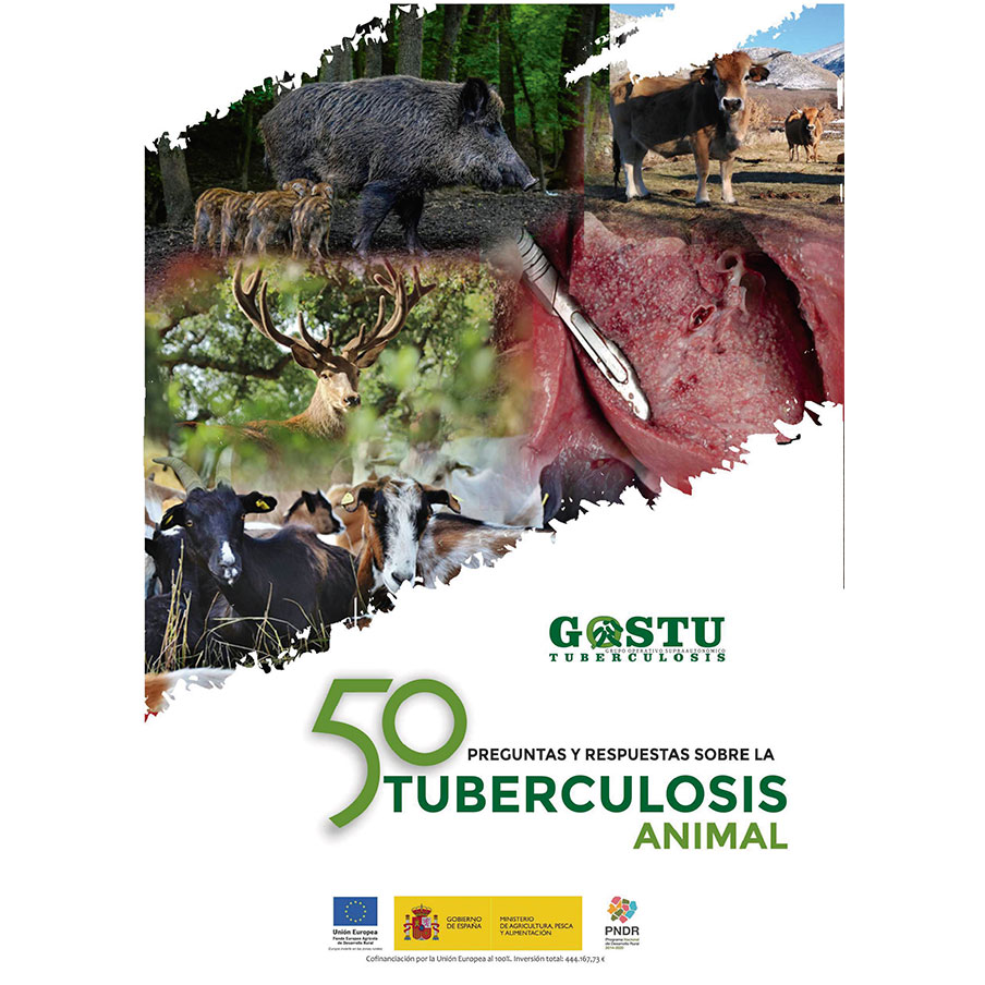 50 preguntas y respuestas sobre la tuberculosis